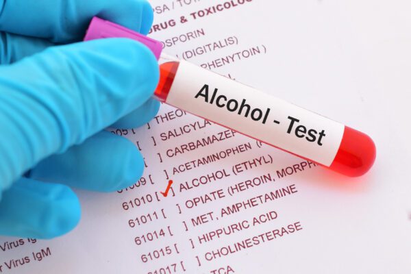 Alcohol test photo
